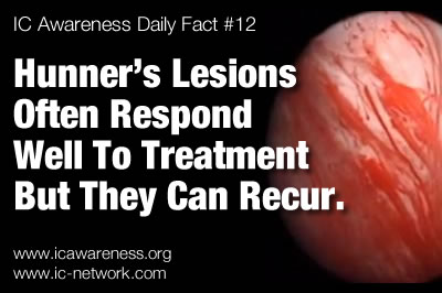 Hunner's lesions often respond well to treatment but they can recur. 