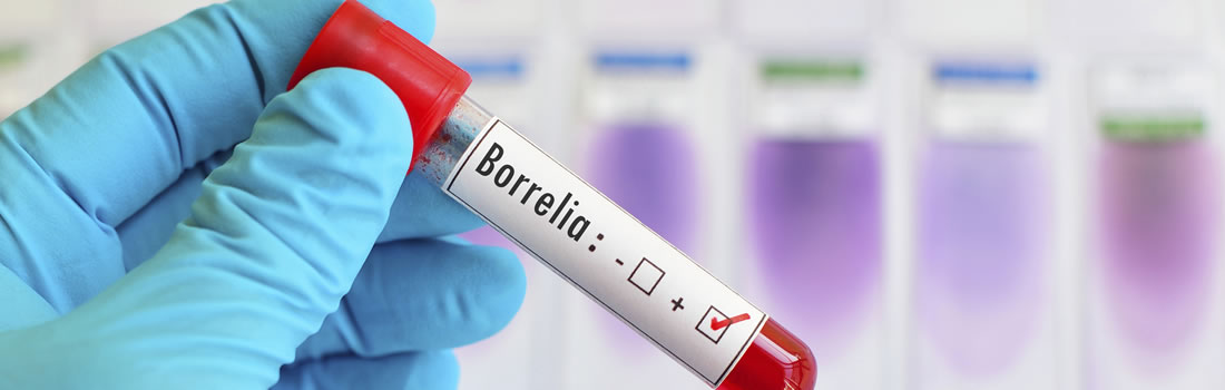 Lyme Disease Borrelia bacteria in a test tube